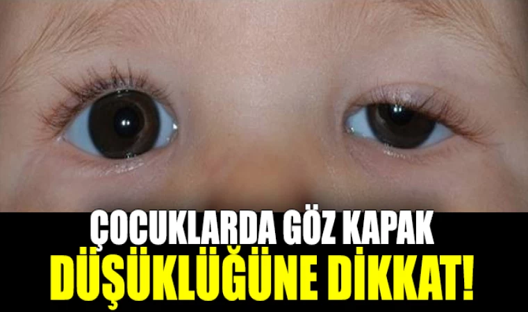 Bebeklerde Göz Kapağı Düşüklüğü İyileşebiliyor