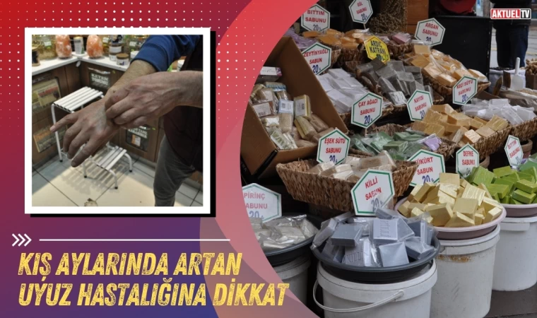 Kış Aylarında Artan Uyuz Hastalığına Dikkat