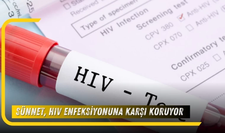 Sünnet, HIV Enfeksiyonuna Karşı Koruyor