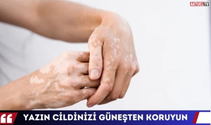 Yazın Cildinizi Güneşten Koruyun
