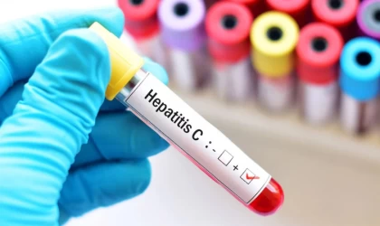 Hepatit Hastaları Beslenmede Karaciğerlerini Zorlamamalı