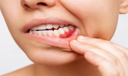 Diş Eti Rahatsızlığının Sebebi Sert Fırça