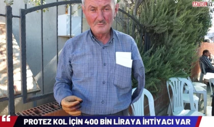 Protez Kol İçin 400 Bin Liraya İhtiyacı Var