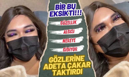 Bir Bu Eksikti, Gözlerine Adeta Çakar Taktırdı